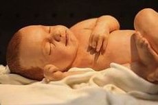 解析试管移植后呼吸困难的原因，移植后呼吸困难是否会影响着床